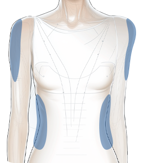 슬리밍 (Slimming) 이미지