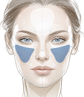 앞광대 (Anterior Cheekbones) 이미지